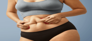 Tummy Tuck Surgery in Coimbatore