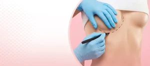 Breast Lift Surgery Recovery: A Week-by-Week Guide