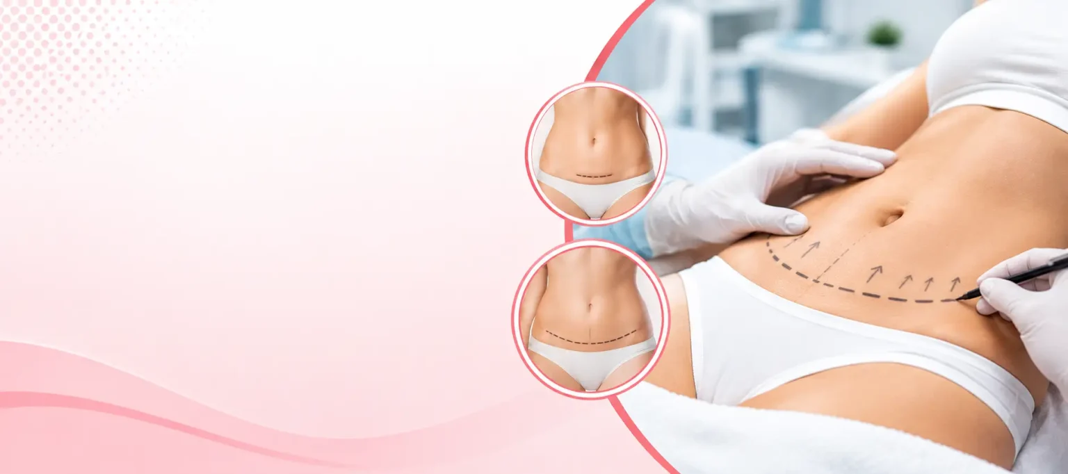 Vaginoplasty Surgery – Benefits, Recovery Time and Expected Results