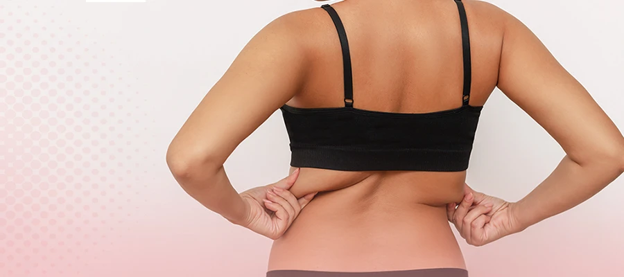 Back fat removal treatment