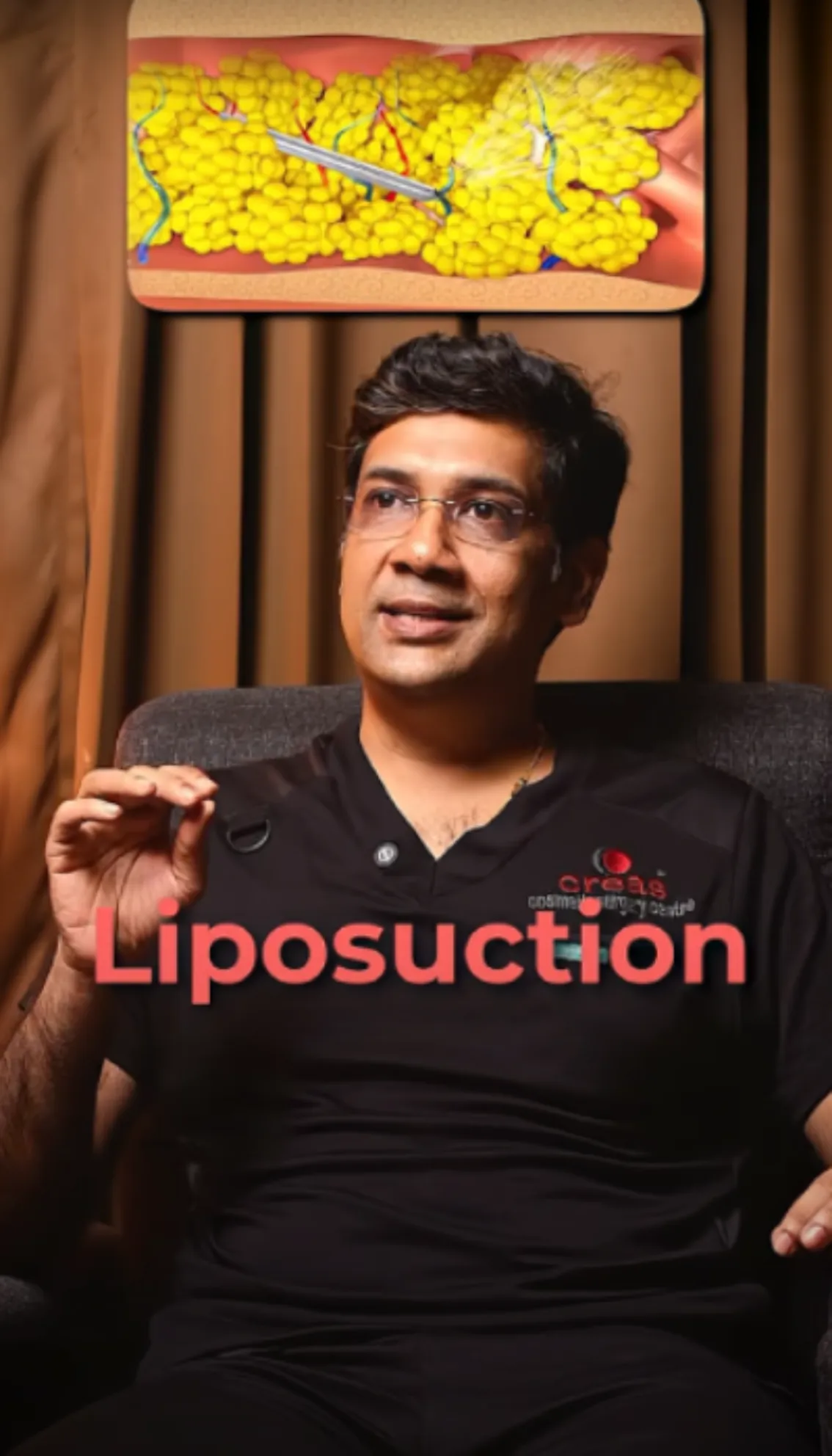 Liposuction - Doctors Talk