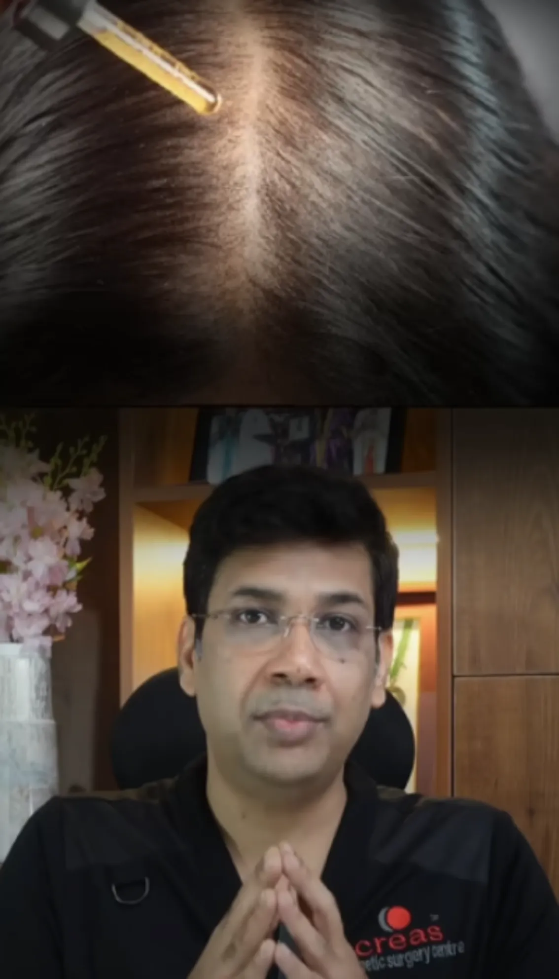 Minoxidil Hair Growth - Doctors Talk