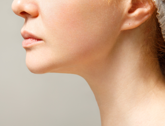 Double Chin Reduction