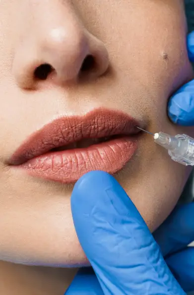Non-Surgical Fillers Treatment