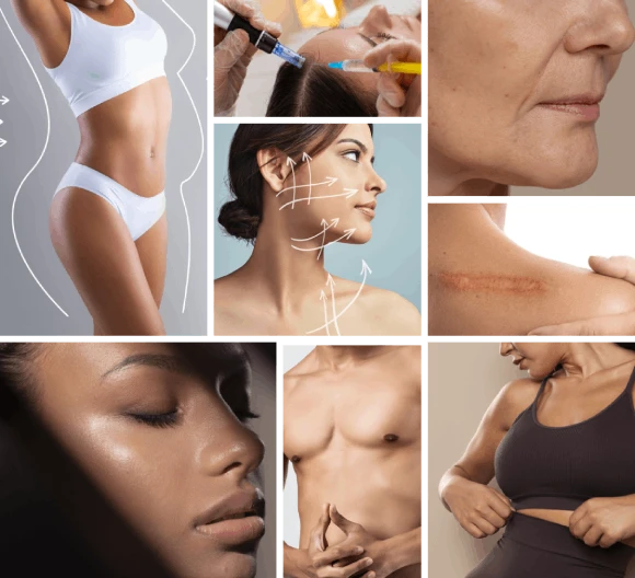 Cosmetic Surgery in Coimbatore