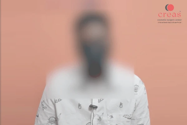 Gynaecomastia-Experience