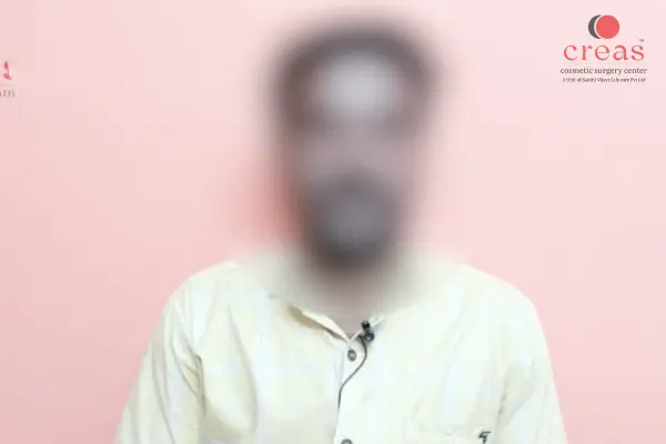 Gynecomastia - Surgery Client Testimonials