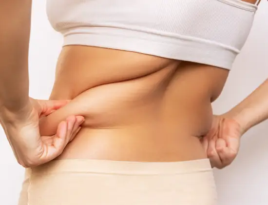 Hip Liposuction Handle Reduction