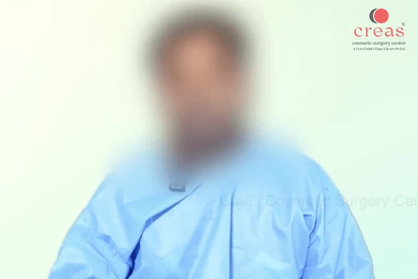 Male Chest Fat Surgery-Experience