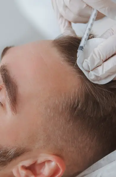 PRP hair restoration therapy