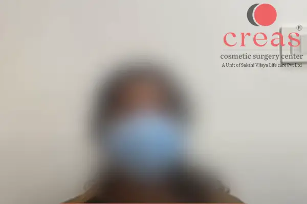 Chest Reduction Patient Feedback