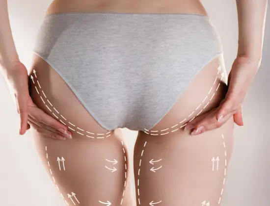 Thigh fat reduction treatment