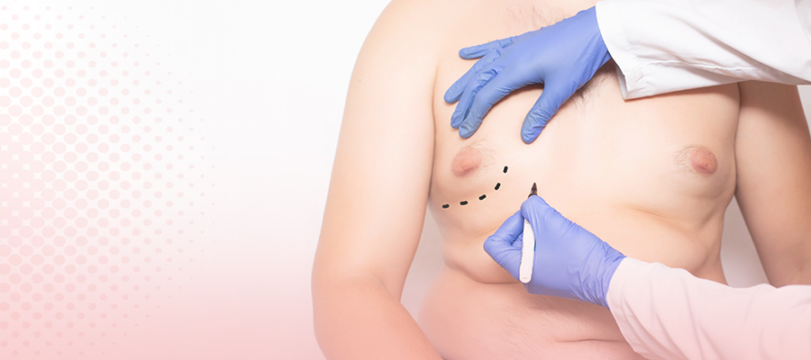 Gynaecomastia Cosmetic Chest Procedure