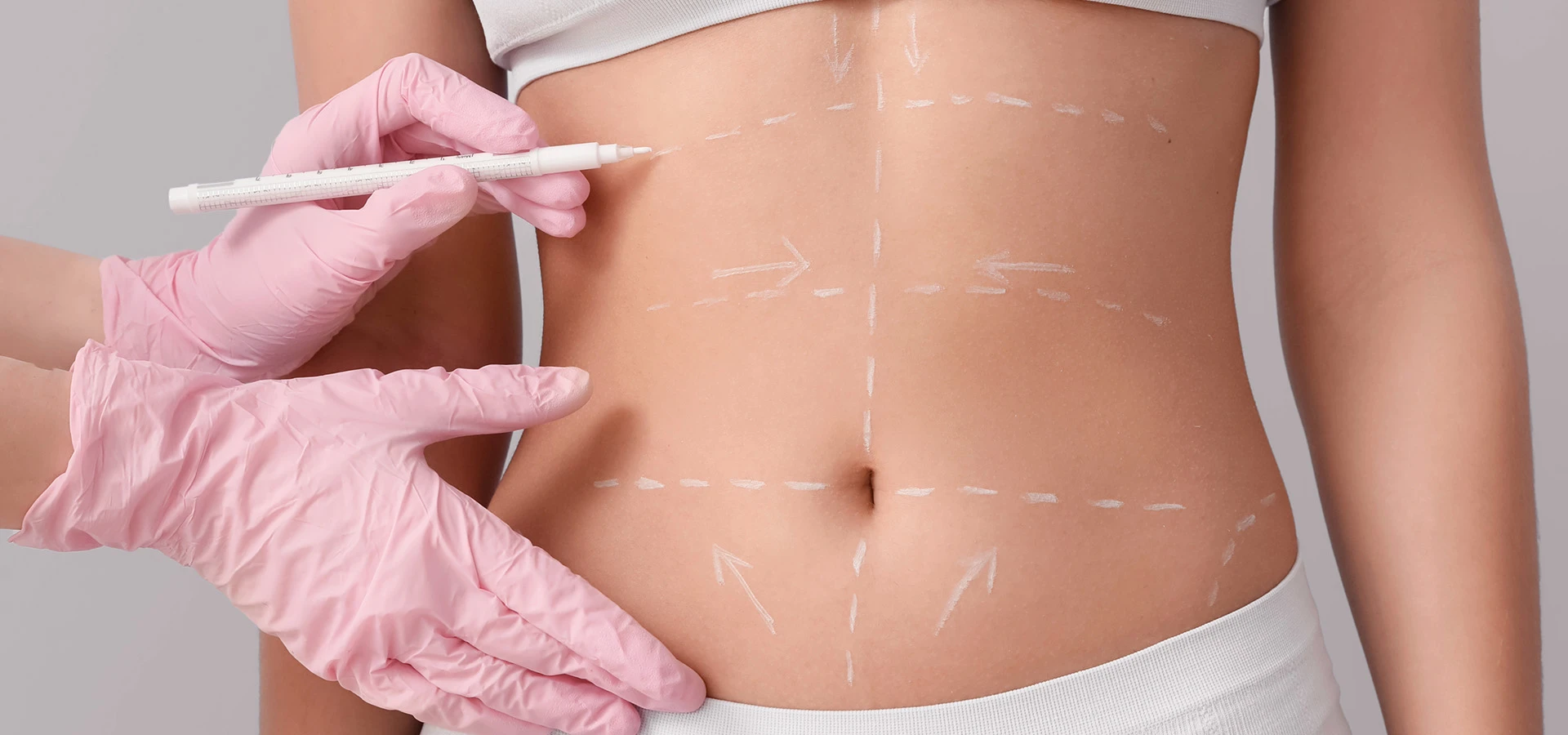 Tummy Tuck Surgery